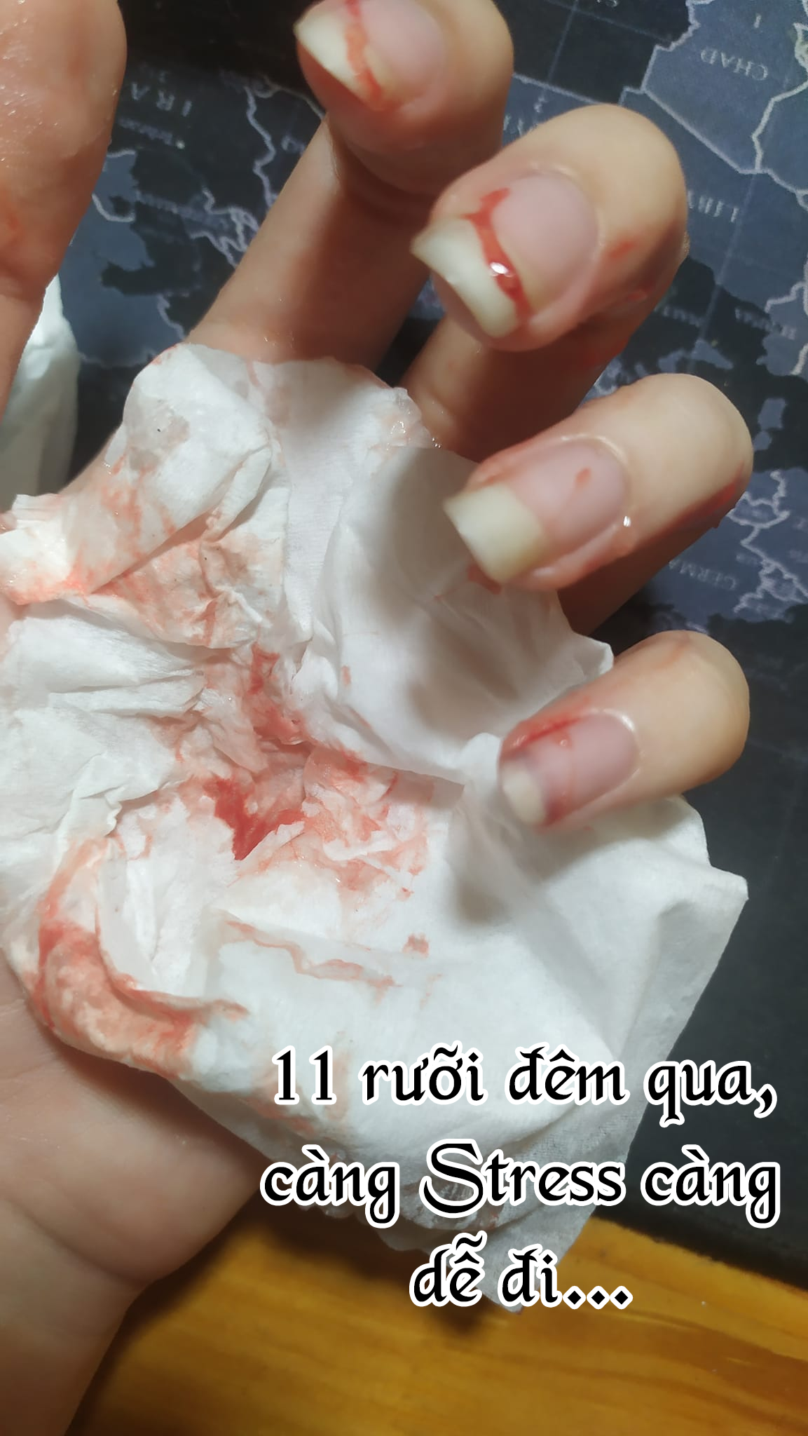 Đọc truyện hentai Anh muốn xem chứ gì Oneshot